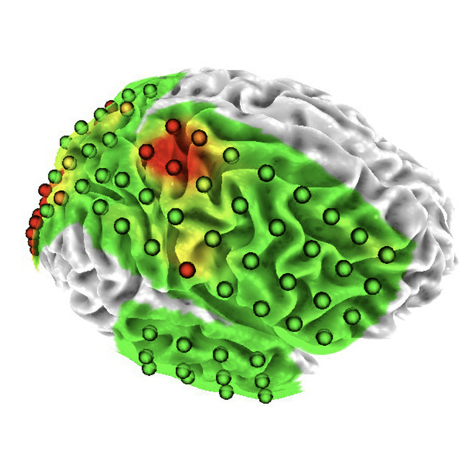  I-BRAIN